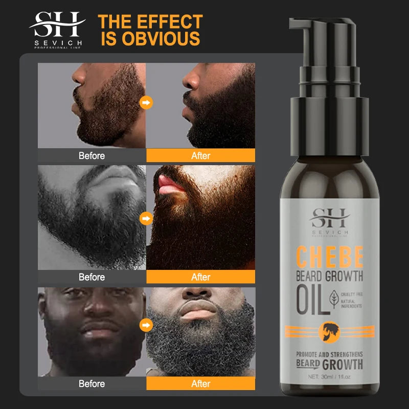 Chebe Beard Growth Oil For Men